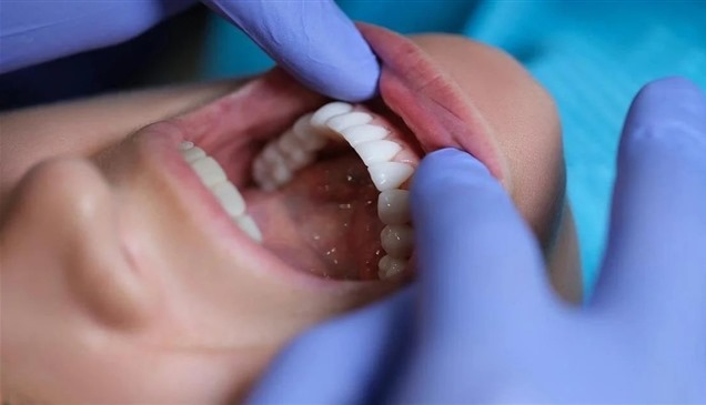تسوس الأسنان يلحق ضرراً بالدماغ
