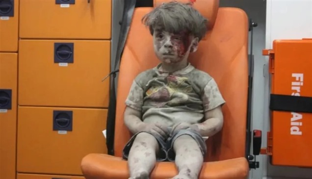 الطفل عمران الذي هزت صورته العالم قبل 9 سنوات يروي قصته لأول مرة
