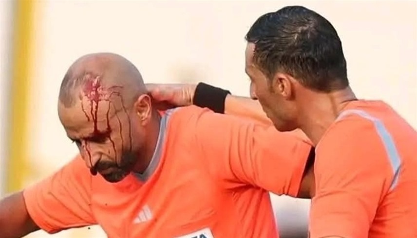 الحكم المساعد مروان سعد ينزف بعد الاعتداء عليه (إكس)