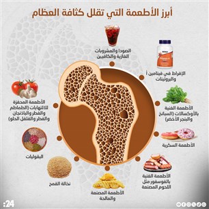  أبرز الأطعمة التي تقلل كثافة العظام
