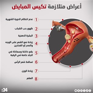 أعراض متلازمة تكيس المبايض