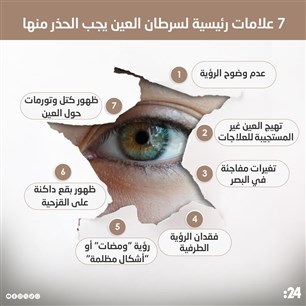 7 علامات رئيسية لسرطان العين يجب الحذر منها
